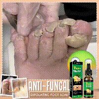 Jaysuing Ginger Nail Care Solution Gentle Care for Hands and Feet, Soft Nails, Smooth Nail Surface, Moisturizing and Brightening Nail Liquid