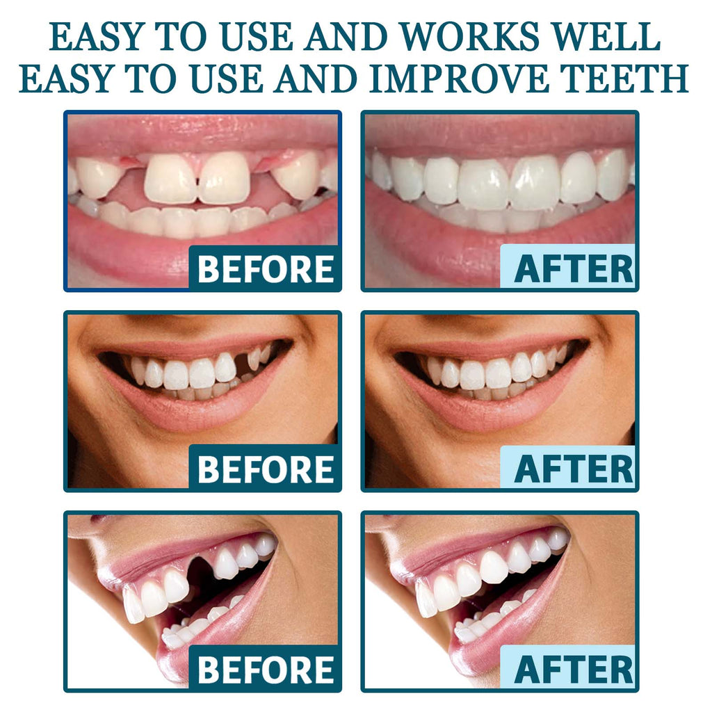 EELHOE Adjustable Snap-on Dentures Temporary Tooth Filling Gap Repair Teeth Correction Denture Kit