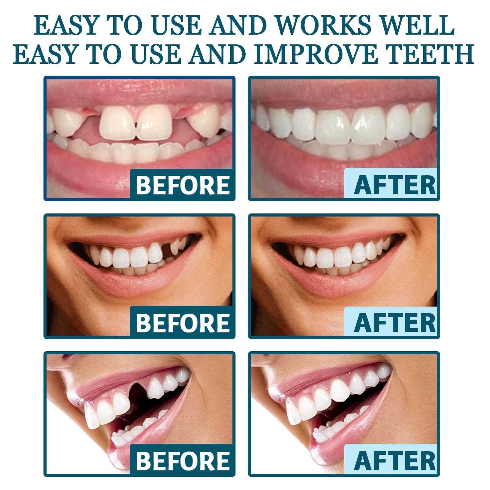 EELHOE Adjustable Snap-on Dentures Temporary Tooth Filling Gap Repair Teeth Correction Denture Kit