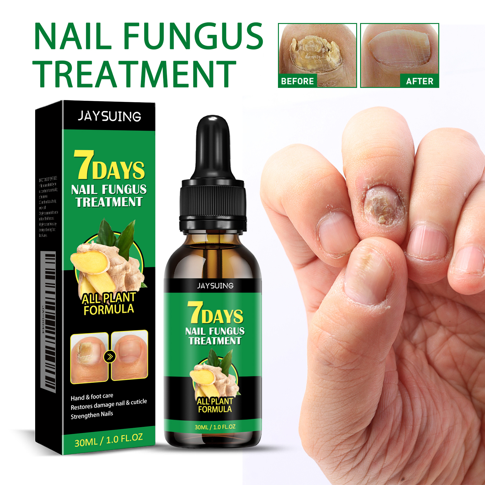 Jaysuing Ginger Nail Care Solution Gentle Care for Hands and Feet, Soft Nails, Smooth Nail Surface, Moisturizing and Brightening Nail Liquid