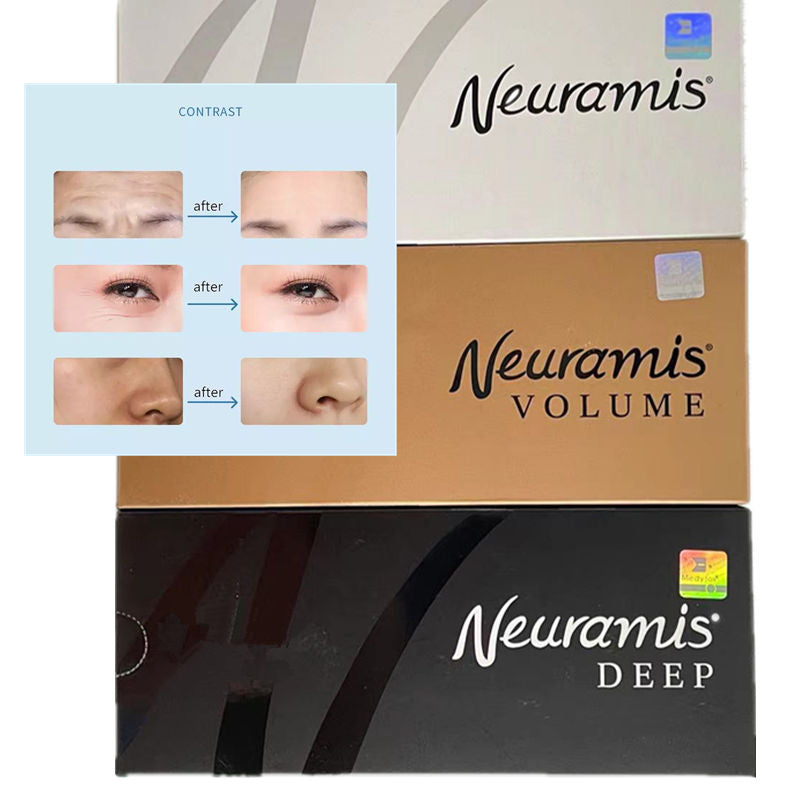 Korea Neuramis Deep Volume Dermal Filler 1ml for Face Lift