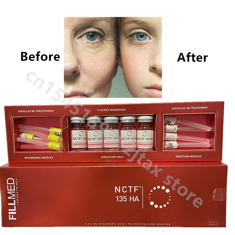 Nctf 135 Hyaluronic Acid Injection - Premium Dermal Filler for Skin Rejuvenation