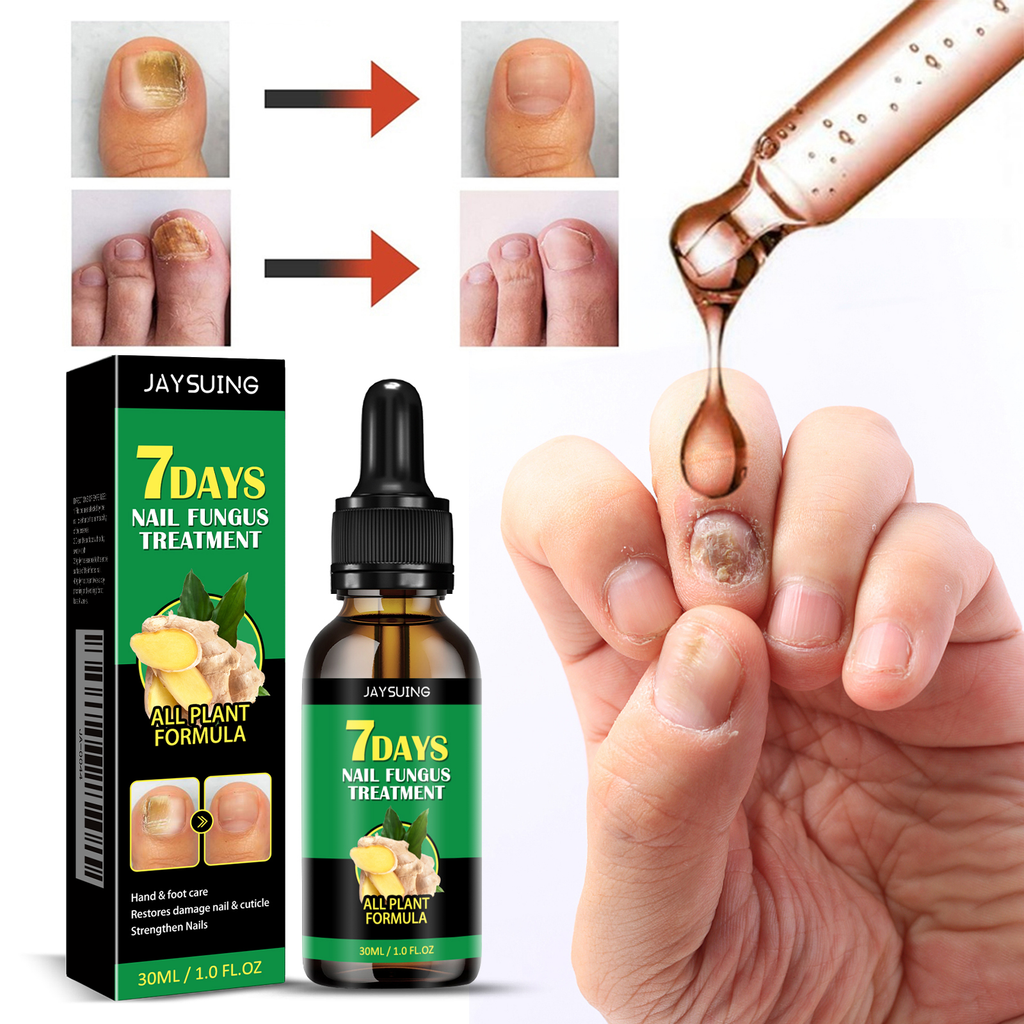 Jaysuing Ginger Nail Care Solution Gentle Care for Hands and Feet, Soft Nails, Smooth Nail Surface, Moisturizing and Brightening Nail Liquid