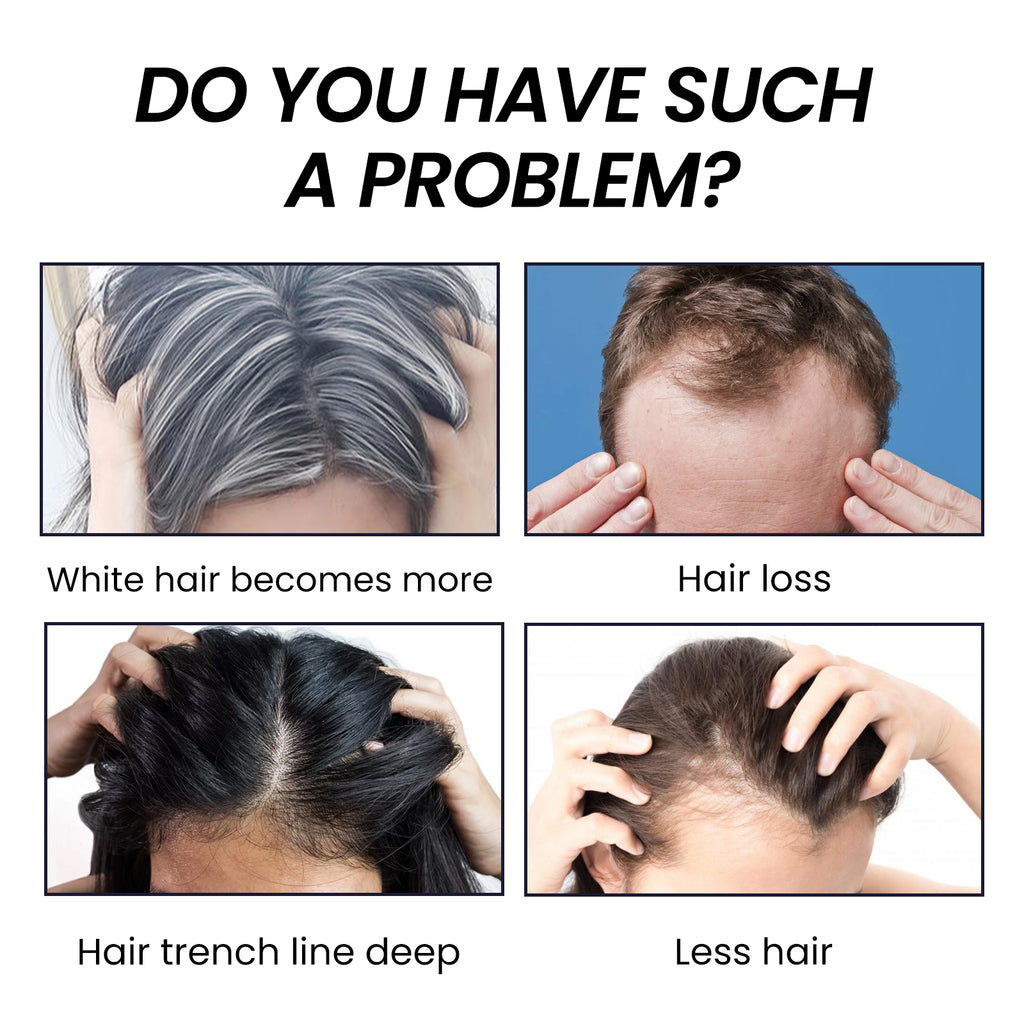 OUHOE Bamboo Charcoal Shampoo Soap Deep Cleansing Scalp Strengthening Hair Nourishing Repairing Dryness Shampoo Bar