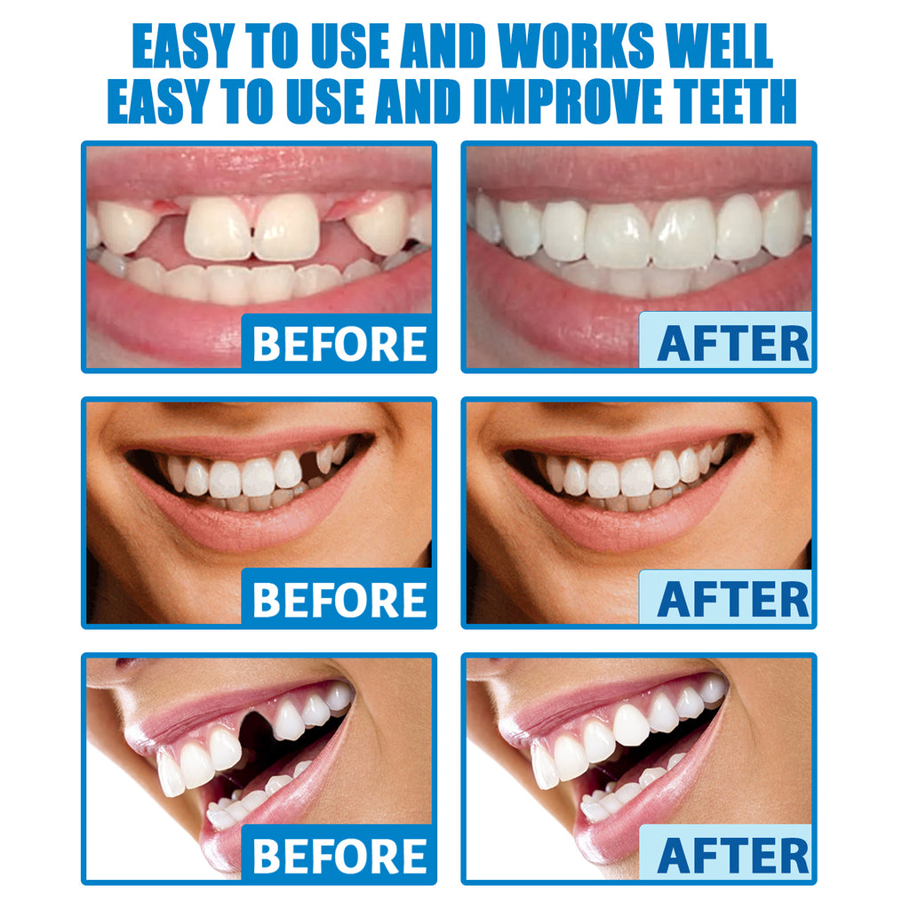 Jaysuing Temporary Tooth Repair Kit Halloween Makeup Teeth Modification Dentures Fill Teeth Gaps Cavities Teeth Gel