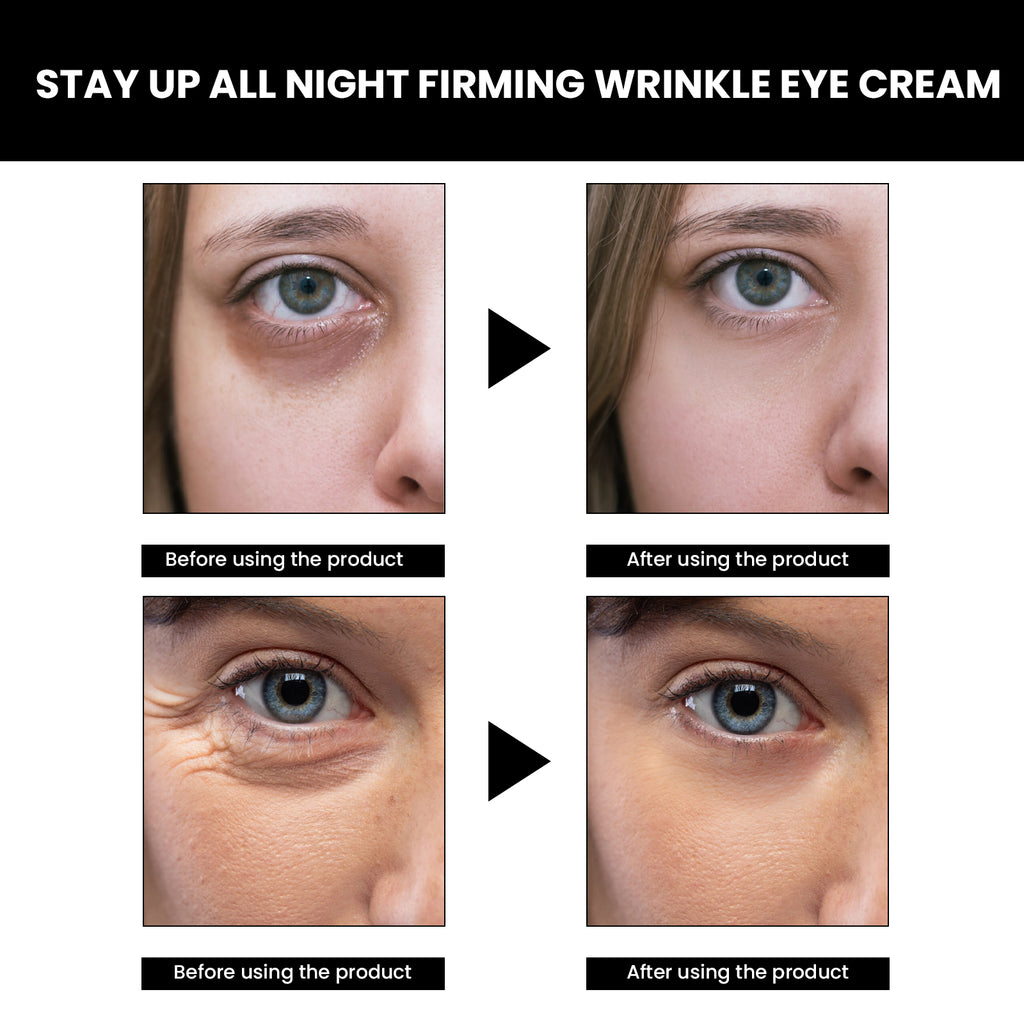 EELHOE Eye Firming Cream Lighten Eye Bags and Dark Circles Firming Moisturizing Skin Repair Eye Cream