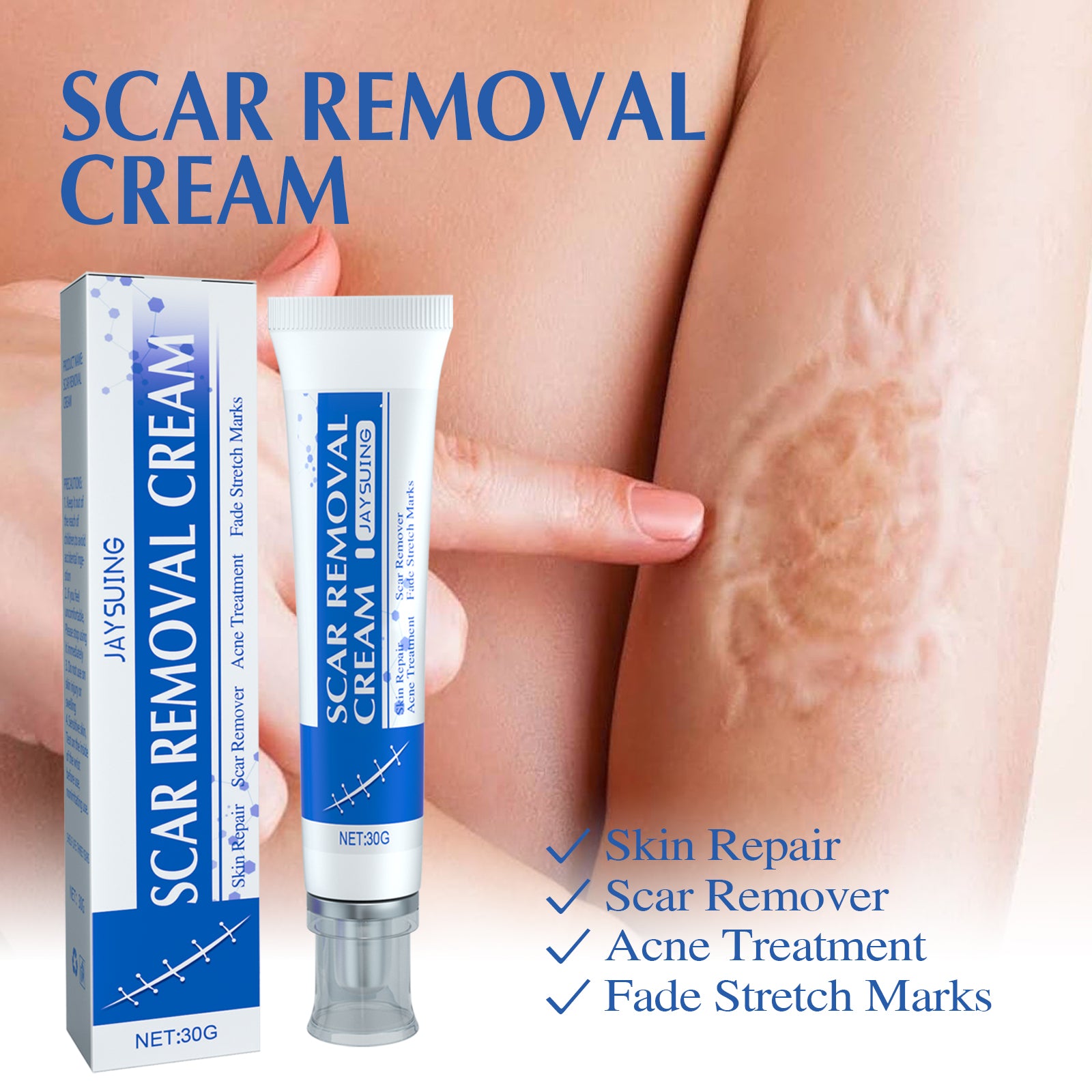 Jaysuing Scar Cream Scar Smoothing and Firming Skin Repair Cream