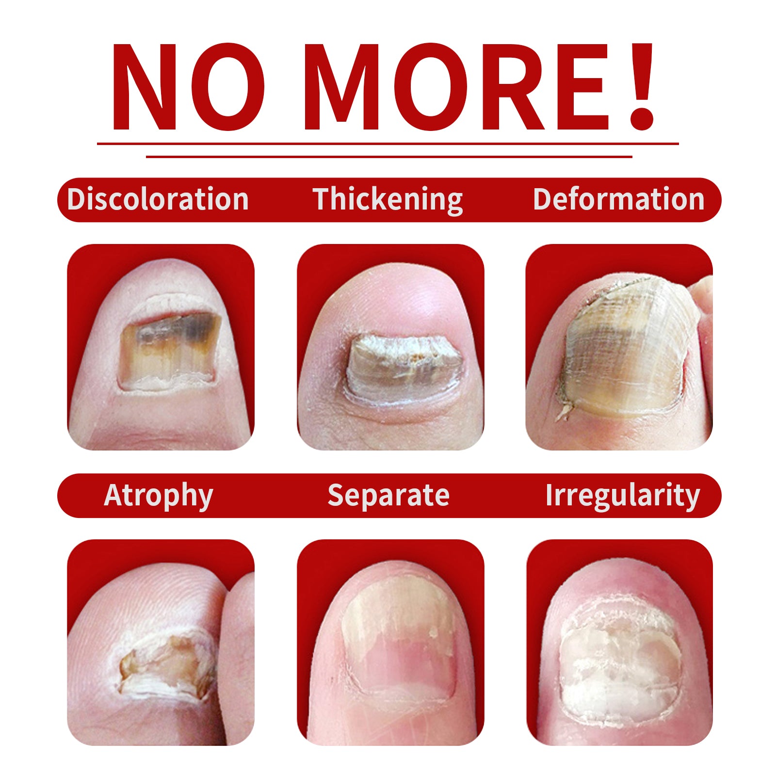 Jaysuing Ginger Nail Care Solution Gentle Care for Hands and Feet, Soft Nails, Smooth Nail Surface, Moisturizing and Brightening Nail Liquid