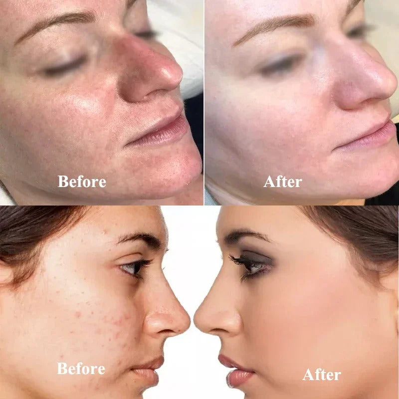 BB CC Cream Glow Face Skin Care Serum Essence Ampoule Foundation Hyaluronic Acid Peptide Brightening Whitening Anti-Wrinkle Acne